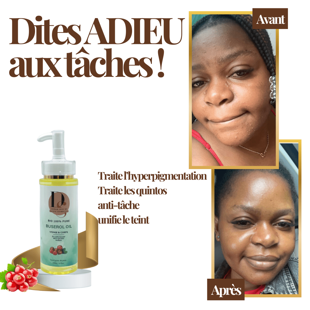 HUILE DE BUSEROLE - 200ml - DREAM SKIN by Sasha Cosmetics